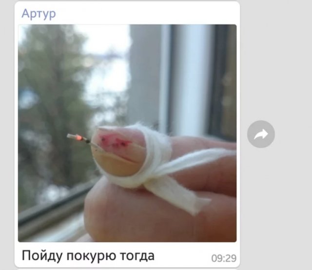 Порезанный палец стал героем мемов (7 фото)