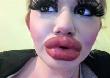 Девушка изменила размер своих губ с помощью 15 хирургических процедур (6 фото)