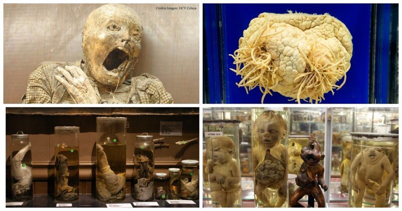 Не для слабонервных: топ-5 самых отвратительных и жутких музеев мира (30 фото)