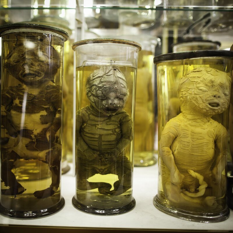 Не для слабонервных: топ-5 самых отвратительных и жутких музеев мира (30 фото)