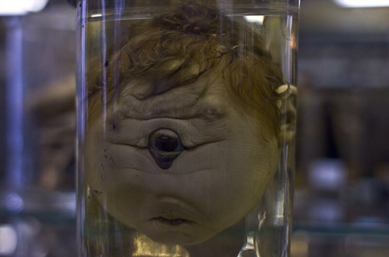 Не для слабонервных: топ-5 самых отвратительных и жутких музеев мира (30 фото)