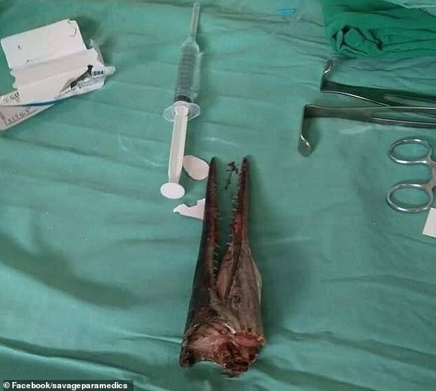 Рыба-игла пронзила мальчику шею насквозь (5 фото)