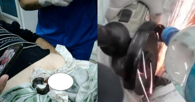 В Запорожье обиженная жена надела гайку на пенис мужа, отомстив ему за измену (4 фото + 1 видео)