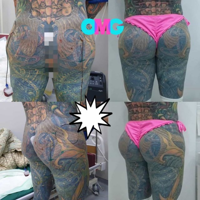 Блогер Александр Шпак решился на еще одну пластическую операцию (5 фото + видео) Блогер Александр Шпак решился на еще одну пластическую операцию (5 фото + видео)