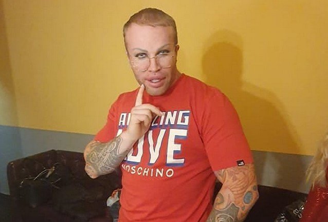 Блогер Александр Шпак решился на еще одну пластическую операцию (5 фото + видео) Блогер Александр Шпак решился на еще одну пластическую операцию (5 фото + видео)