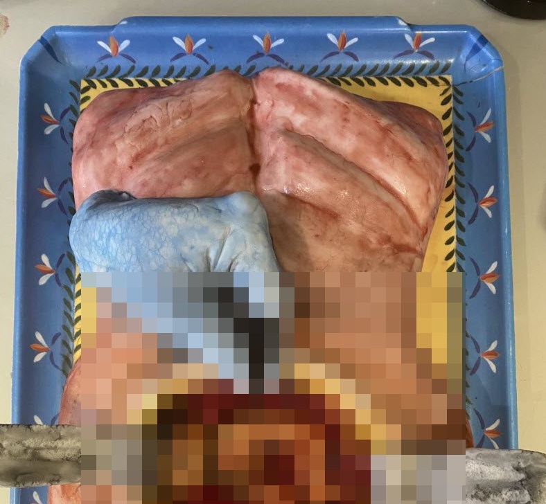 У хирургов специфическое чувство юмора (2 фото)