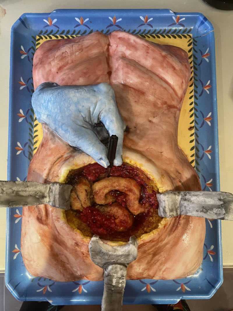 У хирургов специфическое чувство юмора (2 фото)