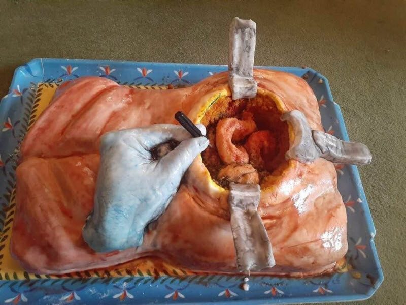 У хирургов специфическое чувство юмора (2 фото)