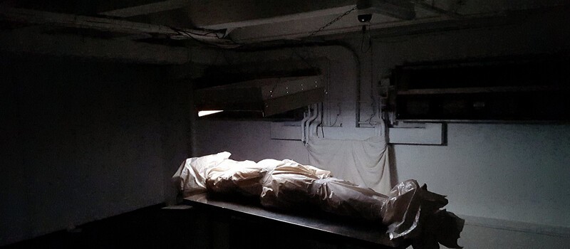 Крипота дня: в Питере объявили тендер на покупку частей тела человека (7 фото)