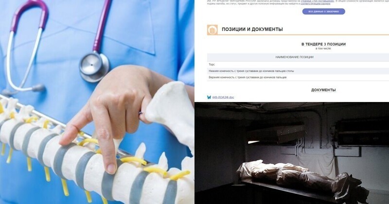 Крипота дня: в Питере объявили тендер на покупку частей тела человека (7 фото)