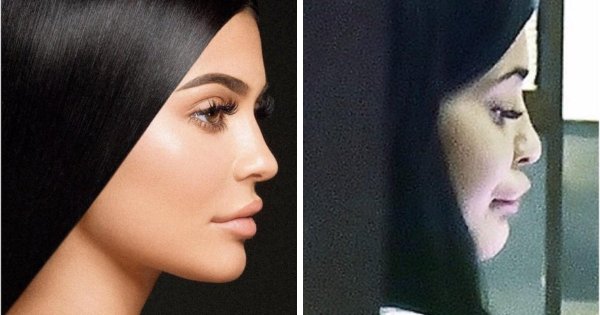 Instagram и реальность: люди, которые "отфотошопили" себя до неузнаваемости (15 фото)