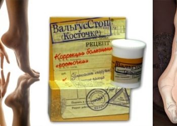 Вальгусстоп
